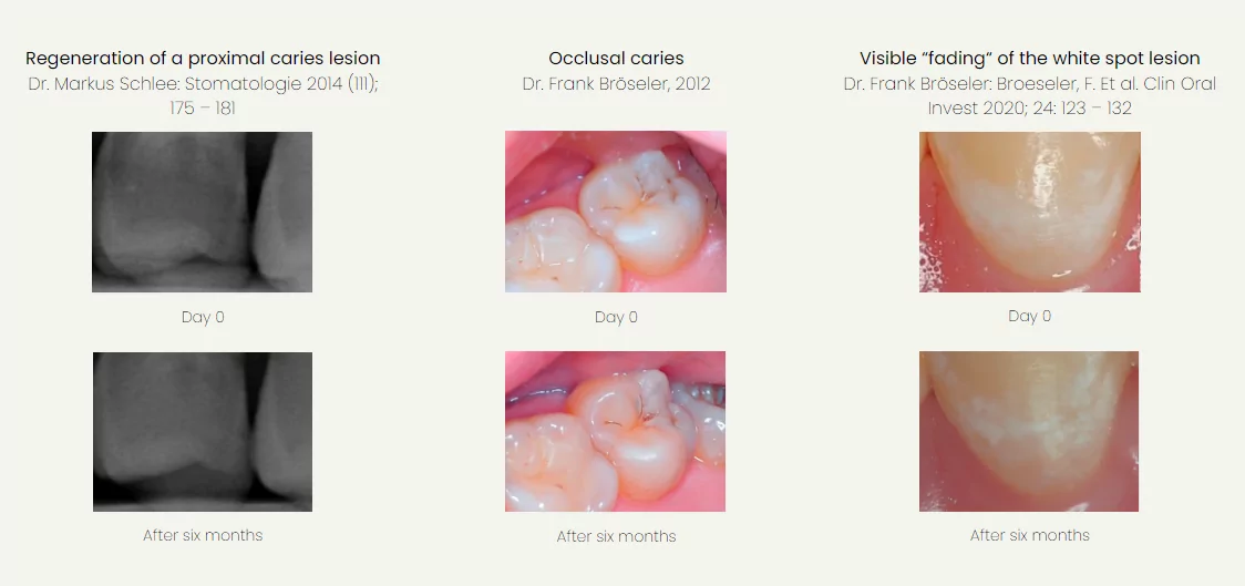 curodont-reparacion-para-profesionales-dentales-evidencia-visible